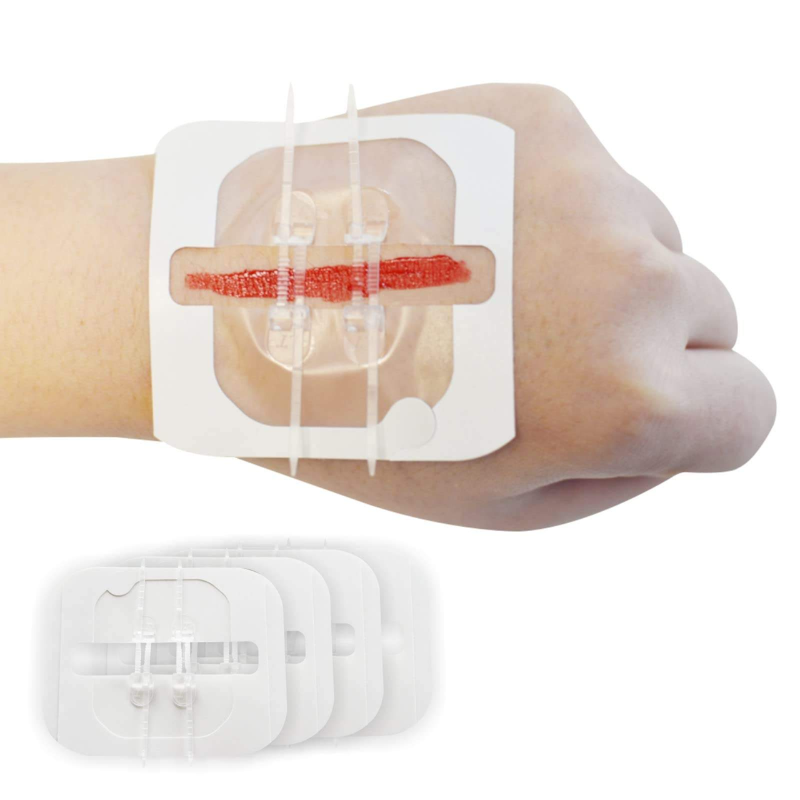 Wound Closure Strip Kit